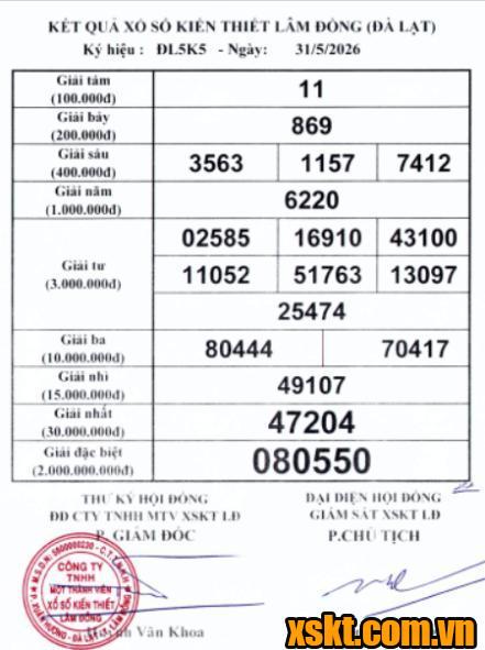 XSDL ngày 31/5/2026